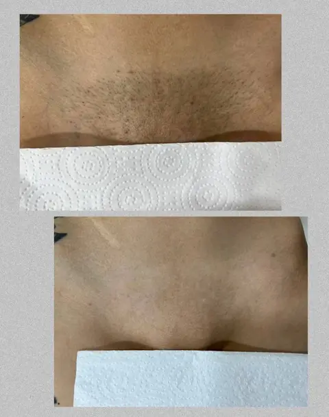 Bikini, tanned skin: Before / After