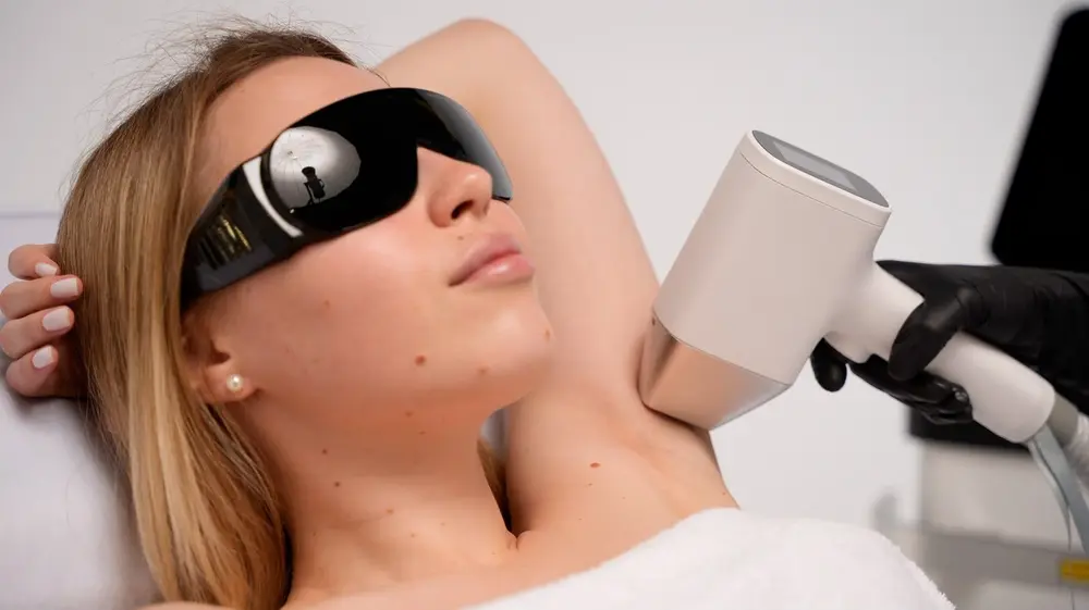 Client in protective glasses during underarm laser hair removal